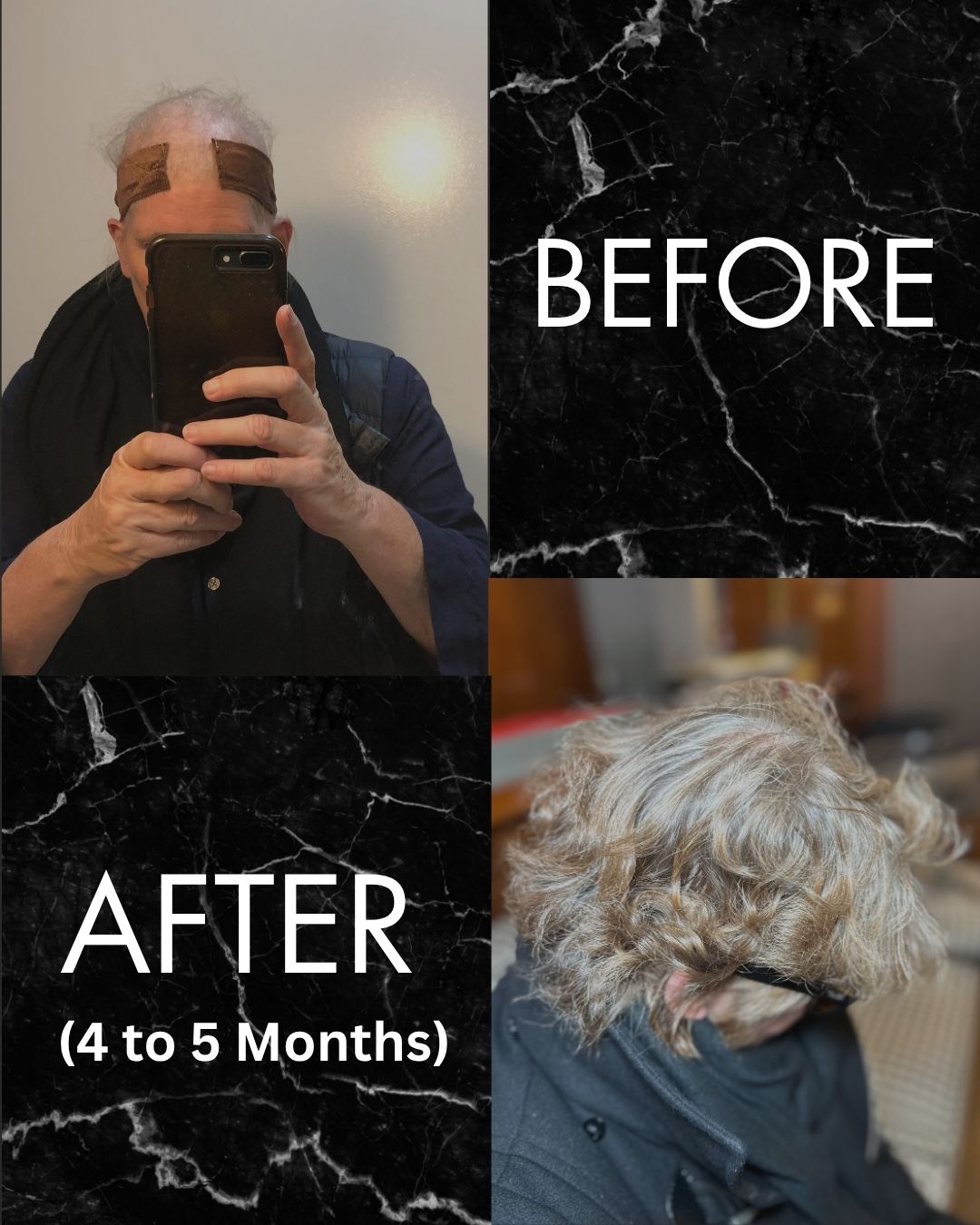 Hair Growth Tonic – Revitalizing Formula for Thicker, Healthier Hair - Mia Wagner Salon