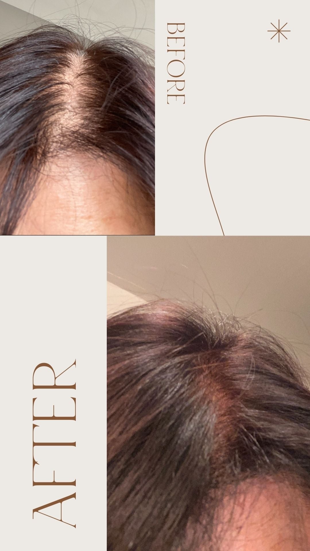 Hair Growth Tonic – Revitalizing Formula for Thicker, Healthier Hair - Mia Wagner Salon